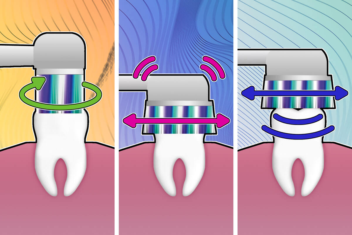 different types of electric toothbrushes