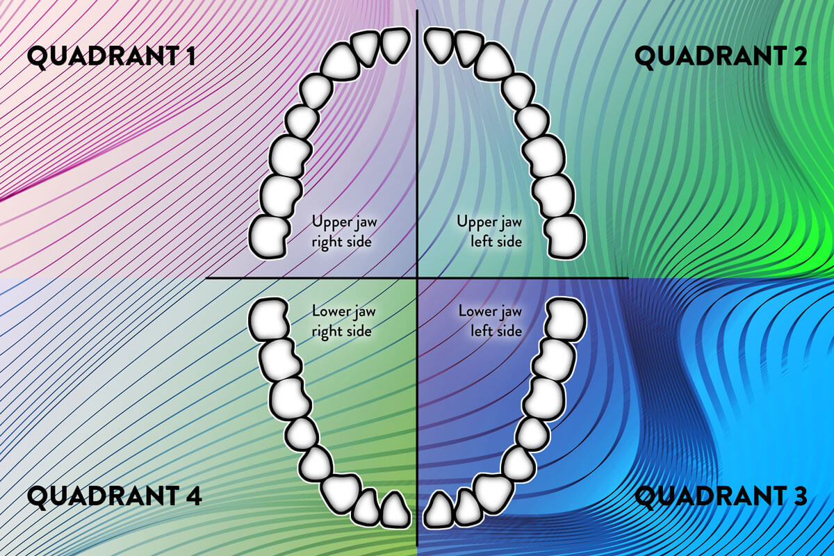 jaw split into four quadrants